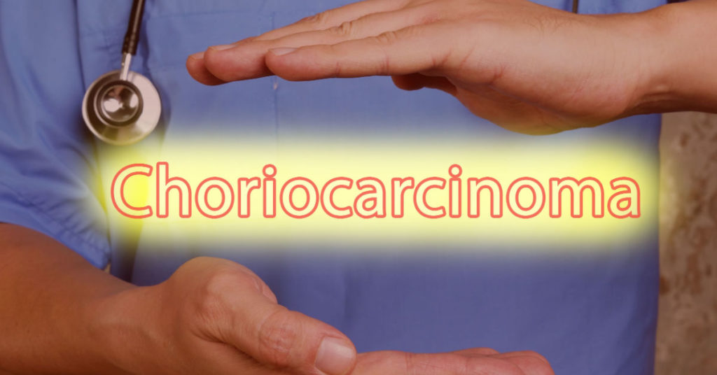 carcinoma-of-the-choriocarcinoma:-symptoms,-causes,-diagnosis,-and-therapy