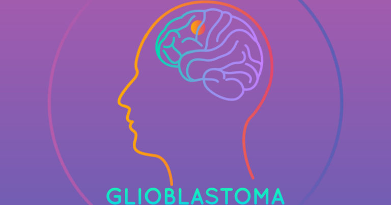 types,-symptoms,-causes,-treatment,-and-diagnosis-of-glioblastoma