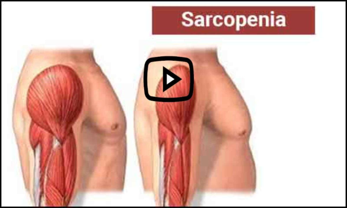 researchers-at-ub-create-a-novel-instrument-to-evaluate-the-existence-and-severity-of-sarcopenia