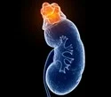certain-blood-and-urine-indicators-can-indicate-a-person’s-likelihood-of-acquiring-chronic-kidney-disease